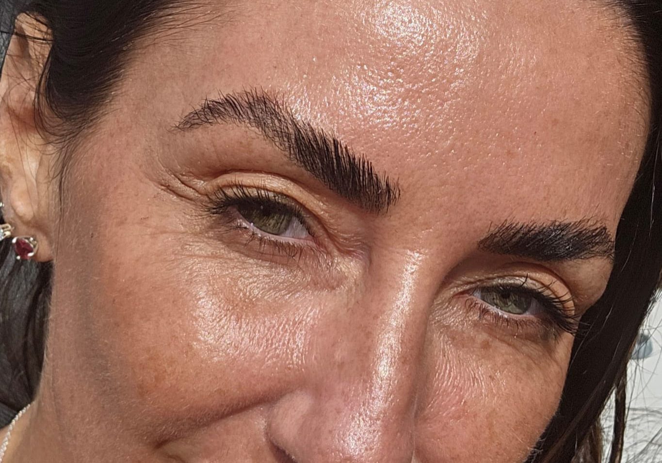 Facials (chemical peel)